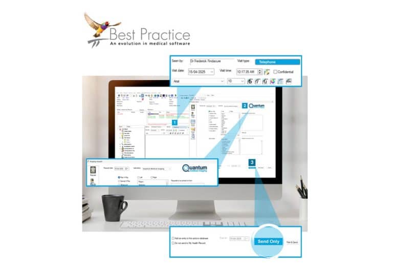Best Practice - Send Only Option