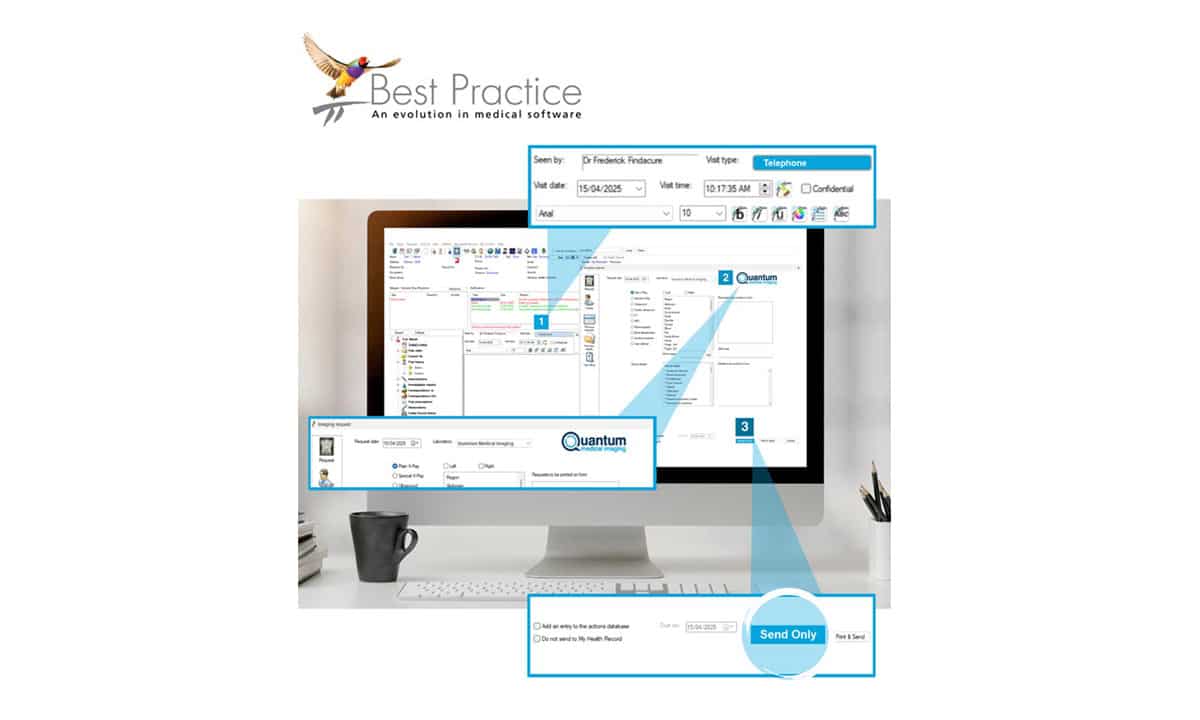 Best Practice - Send Only Option